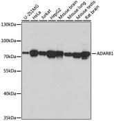 ADAR2 / ADARB1 Antibody - Western blot analysis of extracts of various cell lines using ADARB1 Polyclonal Antibody at dilution of 1:1000.