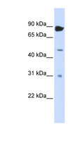 ADAR2 / ADARB1 Antibody - ADARB1 / RED1 antibody Western blot of Transfected 293T cell lysate. This image was taken for the unconjugated form of this product. Other forms have not been tested.