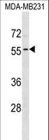 ADAT1 Antibody - ADAT1 Antibody western blot of MDA-MB231 cell line lysates (35 ug/lane). The ADAT1 antibody detected the ADAT1 protein (arrow).