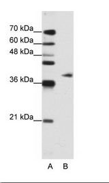 ADAT1 Antibody - A: Marker, B: Jurkat Cell Lysate.  This image was taken for the unconjugated form of this product. Other forms have not been tested.