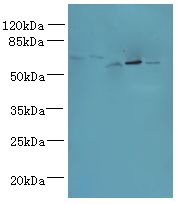 ADAT1 Antibody - Western blot. All lanes: ADAT1 antibody at 6 ug/ml. Lane 1: Mouse kidney tissue. Lane 2: Thp-1 whole cell lysate. Lane 3: Mouse liver tissue. Lane 4: MDA-MB-231 whole cell lysate. Lane 5: HL60 whole cell lysate. Secondary Goat polyclonal to Rabbit IgG at 1:10000 dilution. Predicted band size: 55 kDa. Observed band size: 55 kDa.