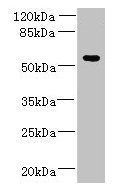 ADAT1 Antibody - Western blot All lanes: ADAT1 antibody at 6µg/ml + MDA-MB-231 whole cell lysate Secondary Goat polyclonal to rabbit IgG at 1/10000 dilution Predicted band size: 56, 39 kDa Observed band size: 56 kDa