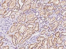 ADAT1 Antibody - Immunochemical staining of human ADAT1 in human kidney with rabbit polyclonal antibody at 1:100 dilution, formalin-fixed paraffin embedded sections.