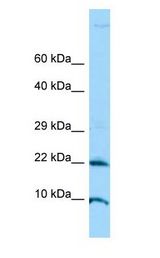 ADAT2 Antibody - ADAT2 antibody Western Blot of Jurkat.  This image was taken for the unconjugated form of this product. Other forms have not been tested.