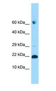 ADAT2 Antibody - ADAT2 antibody Western Blot of 293T.  This image was taken for the unconjugated form of this product. Other forms have not been tested.