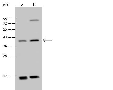 ADAT3 Antibody - Anti-ADAT3 rabbit polyclonal antibody at 1:500 dilution. Lane A: 293T Whole Cell Lysate. Lane B: Jurkat Whole Cell Lysate. Lysates/proteins at 30 ug per lane. Secondary: Goat Anti-Rabbit IgG (H+L)/HRP at 1/10000 dilution. Developed using the ECL technique. Performed under reducing conditions. Predicted band size: 38 kDa. Observed band size: 38 kDa.