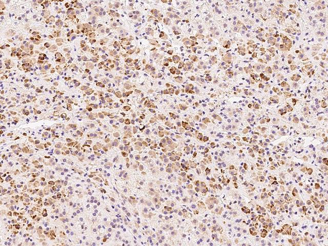 ADAT3 Antibody - Immunochemical staining of human ADAT3 in human adrenal gland with rabbit polyclonal antibody at 1:1500 dilution, formalin-fixed paraffin embedded sections.