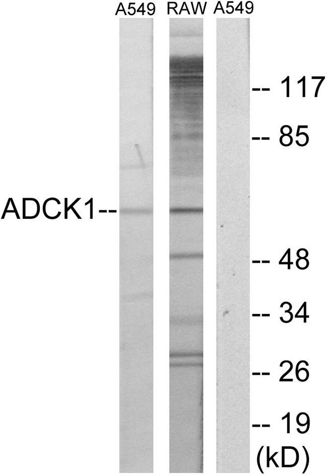 ADCK1 Antibody - Western blot analysis of lysates from A549 and RAW264.7 cells, using ADCK1 Antibody. The lane on the right is blocked with the synthesized peptide.