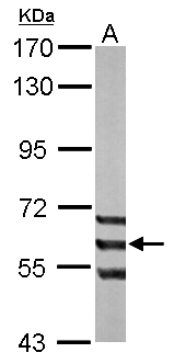ADCK1 Antibody - Sample (50 ug of whole cell lysate). A: mouse liver. 7.5% SDS PAGE. ADCK1 antibody diluted at 1:1000.