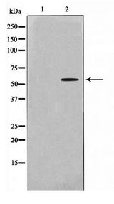 ADCK1 Antibody - Western blot of A549 cell lysate using ADCK1 Antibody