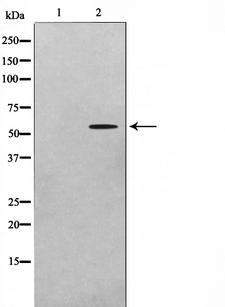 ADCK1 Antibody - Western blot analysis on A549 cell lysates using ADCK1 antibody. The lane on the left is treated with the antigen-specific peptide.
