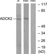 ADCK2 Antibody - Western blot analysis of lysates from Jurkat and K562 cells, using ADCK2 Antibody. The lane on the right is blocked with the synthesized peptide.
