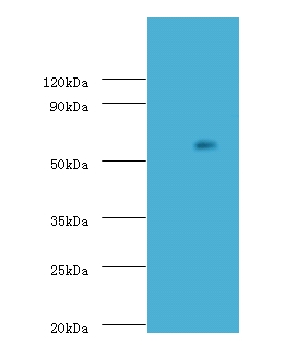 ADCK2 Antibody - Western blot of Uncharacterized aarF domain-containing protein kinase 2 antibody at 2 ug/ml with K562 whole cell lysate. Secondary: Goat polyclonal to Rabbit IgG at 1:15000 dilution. Predicted band size: 69 KDa. Observed band size: 69 KDa.  This image was taken for the unconjugated form of this product. Other forms have not been tested.