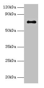 ADCK2 Antibody - Western blot All lanes: Uncharacterized aarF domain-containing protein kinase 2 antibody at 2µg/ml + K562 whole cell lysate Secondary Goat polyclonal to rabbit IgG at 1/15000 dilution Predicted band size: 69 kDa Observed band size: 69 kDa