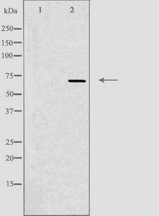 ADCK2 Antibody - Western blot analysis of extracts of Jurkat cells using ADCK2 antibody. The lane on the left is treated with the antigen-specific peptide.