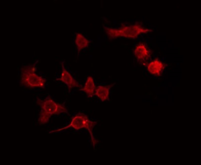 ADCK2 Antibody - Staining HeLa cells by IF/ICC. The samples were fixed with PFA and permeabilized in 0.1% Triton X-100, then blocked in 10% serum for 45 min at 25°C. The primary antibody was diluted at 1:200 and incubated with the sample for 1 hour at 37°C. An Alexa Fluor 594 conjugated goat anti-rabbit IgG (H+L) Ab, diluted at 1/600, was used as the secondary antibody.