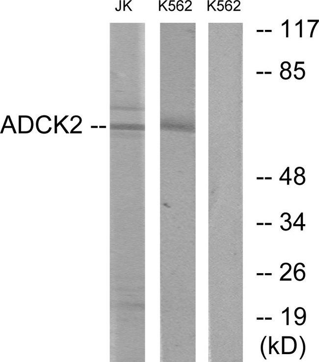 ADCK2 Antibody - Western blot analysis of extracts from Jurkat cells and K562 cells, using ADCK2 antibody.