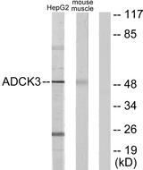 ADCK3 / CABC1 Antibody - Western blot analysis of lysates from HepG2 and mouse muscle cells, using ADCK3 Antibody. The lane on the right is blocked with the synthesized peptide.
