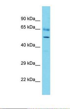 ADCK3 / CABC1 Antibody - Western blot of Human Thymus Tumor. ADCK3 antibody dilution 1.0 ug/ml.  This image was taken for the unconjugated form of this product. Other forms have not been tested.