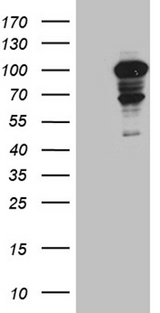 ADCK3 / CABC1 Antibody - HEK293T cells were transfected with the pCMV6-ENTRY control. (Left lane) or pCMV6-ENTRY ADCK3. (Right lane) cDNA for 48 hrs and lysed