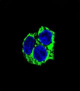 ADCK3 / CABC1 Antibody - Confocal immunofluorescence of CABC1 Antibody with HepG2 cell followed by Alexa Fluor 488-conjugated goat anti-mouse lgG (green). DAPI was used to stain the cell nuclear (blue).
