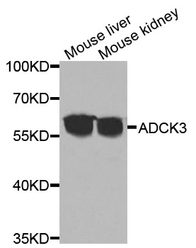 ADCK3 / CABC1 Antibody - Western blot analysis of extracts of various cells.