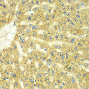 ADCK3 / CABC1 Antibody - Immunohistochemistry of paraffin-embedded rat liver tissue.
