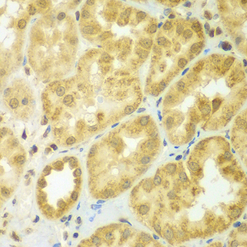 ADCK3 / CABC1 Antibody - Immunohistochemistry of paraffin-embedded human kidney tissue.