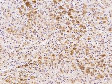 ADCK3 / CABC1 Antibody - Immunochemical staining of human ADCK3 in human adrenal gland with rabbit polyclonal antibody at 1:300 dilution, formalin-fixed paraffin embedded sections.