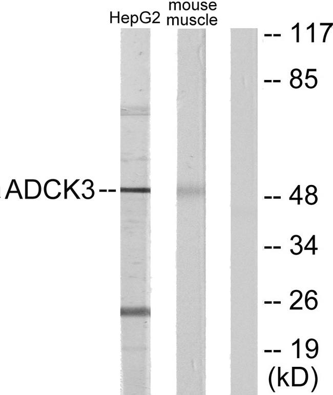 ADCK3 / CABC1 Antibody - Western blot analysis of extracts from HepG2 cells and mouse muscle cells, using ADCK3 antibody.