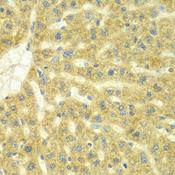 ADCK3 / CABC1 Antibody - Immunohistochemistry of paraffin-embedded Rat liver using ADCK3 Polyclonal Antibody at dilution of 1:100 (40x lens).