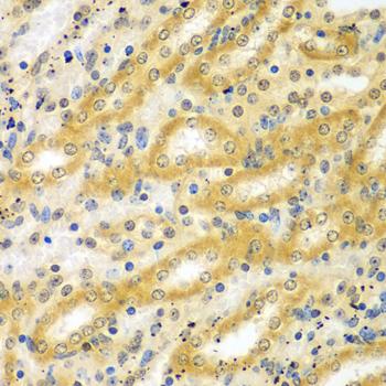 ADCK3 / CABC1 Antibody - Immunohistochemistry of paraffin-embedded Mouse kidney using ADCK3 Polyclonal Antibody at dilution of 1:100 (40x lens).