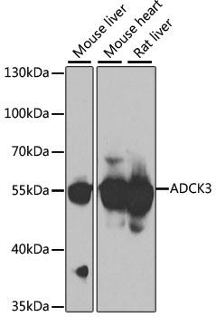 ADCK3 / CABC1 Antibody - Western blot analysis of extracts of various cell lines using ADCK3 Polyclonal Antibody at dilution of 1:1000.