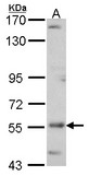 ADCK4 Antibody - Sample (30 ug of whole cell lysate). A: A431 . 7.5% SDS PAGE. ADCK4 antibody. ADCK4 antibody diluted at 1:500.