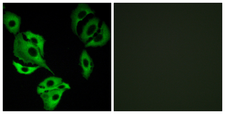 ADCK4 Antibody - Immunofluorescence analysis of A549 cells, using ADCK4 Antibody. The picture on the right is blocked with the synthesized peptide.