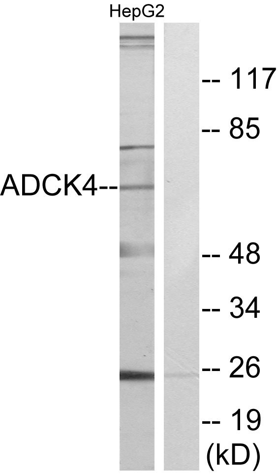 ADCK4 Antibody - Western blot analysis of lysates from HepG2 cells, using ADCK4 Antibody. The lane on the right is blocked with the synthesized peptide.