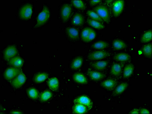 ADCK4 Antibody - Immunofluorescent analysis of A549 cells using ADCK4 Antibody at a dilution of 1:100 and Alexa Fluor 488-congugated AffiniPure Goat Anti-Rabbit IgG(H+L)