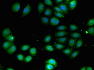 ADCK4 Antibody - Immunofluorescent analysis of A549 cells using ADCK4 Antibody at dilution of 1:100 and Alexa Fluor 488-congugated AffiniPure Goat Anti-Rabbit IgG(H+L)