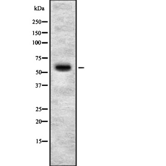 ADCK4 Antibody - Western blot analysis of ADCK4 antibody expression in HepG2 cells lysates.