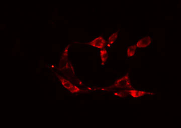 ADCK4 Antibody - Staining HepG2 cells by IF/ICC. The samples were fixed with PFA and permeabilized in 0.1% Triton X-100, then blocked in 10% serum for 45 min at 25°C. The primary antibody was diluted at 1:200 and incubated with the sample for 1 hour at 37°C. An Alexa Fluor 594 conjugated goat anti-rabbit IgG (H+L) antibody, diluted at 1/600, was used as secondary antibody.