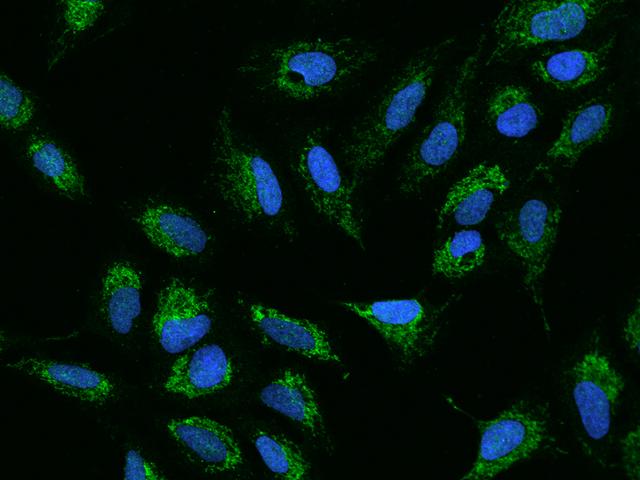 ADCK4 Antibody - Immunofluorescence staining of ADCK4 in U2OS cells. Cells were fixed with 4% PFA, permeabilzed with 0.1% Triton X-100 in PBS, blocked with 10% serum, and incubated with rabbit anti-Human ADCK4 polyclonal antibody (dilution ratio 1:200) at 4°C overnight. Then cells were stained with the Alexa Fluor 488-conjugated Goat Anti-rabbit IgG secondary antibody (green) and counterstained with DAPI (blue). Positive staining was localized to Cytoplasm.