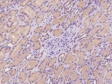 ADCK4 Antibody - Immunochemical staining of human ADCK4 in human kidney with rabbit polyclonal antibody at 1:100 dilution, formalin-fixed paraffin embedded sections.