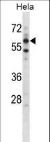 ADCK5 Antibody - Mouse Adck5 Antibody western blot of HeLa cell line lysates (35 ug/lane). The Adck5 antibody detected the Adck5 protein (arrow).