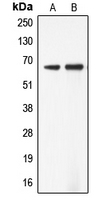 ADCK5 Antibody - Western blot analysis of ADCK5 expression in Jurkat (A); SW13 (B) whole cell lysates.