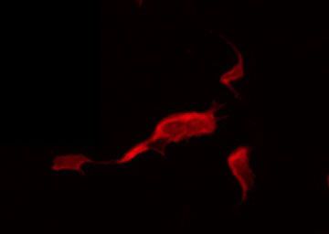 ADCK5 Antibody - Staining HeLa cells by IF/ICC. The samples were fixed with PFA and permeabilized in 0.1% Triton X-100, then blocked in 10% serum for 45 min at 25°C. The primary antibody was diluted at 1:200 and incubated with the sample for 1 hour at 37°C. An Alexa Fluor 594 conjugated goat anti-rabbit IgG (H+L) Ab, diluted at 1/600, was used as the secondary antibody.