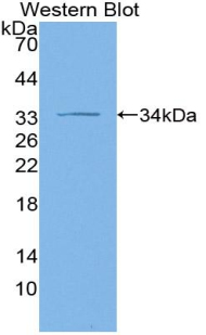ADCY1 / Adenylate Cyclase 1 Antibody - Western blot of recombinant ADCY1 / Adenylate Cyclase 1.