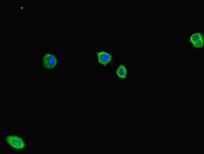 ADCY1 / Adenylate Cyclase 1 Antibody - Immunofluorescent analysis of HepG-2 cells diluted at 1:100 and Alexa Fluor 488-congugated AffiniPure Goat Anti-Rabbit IgG(H+L)