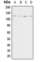 ADCY1 / Adenylate Cyclase 1 Antibody - Western blot analysis of Adenylate Cyclase 1 expression in HeLa (A); HEK293T (B); mouse liver (C); rat kidney (D) whole cell lysates.