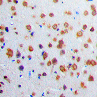 ADCY1 / Adenylate Cyclase 1 Antibody - Immunohistochemical analysis of Adenylate Cyclase 1 staining in human brain formalin fixed paraffin embedded tissue section. The section was pre-treated using heat mediated antigen retrieval with sodium citrate buffer (pH 6.0). The section was then incubated with the antibody at room temperature and detected using an HRP conjugated compact polymer system. DAB was used as the chromogen. The section was then counterstained with hematoxylin and mounted with DPX.