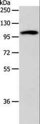 ADCY1 / Adenylate Cyclase 1 Antibody - Western blot analysis of 293T cell, using ADCY1 Polyclonal Antibody at dilution of 1:1000.